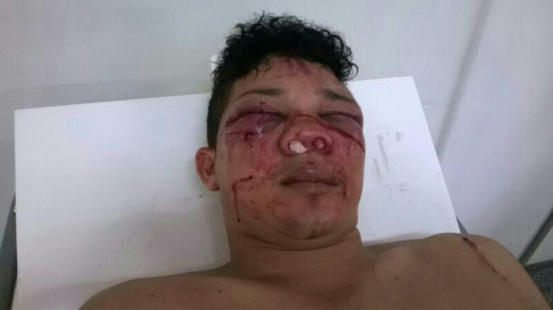 Acusado de matar funcionário público é brutalmente espancado dentro de Presídio