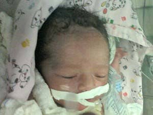 Bebê que nasceu com anomalia rara no Acre é transferido para São Paulo 1 Sandro Alejandro desenvolveu o coração fora do corpo