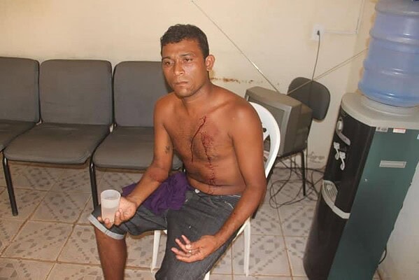 Mulher revoltada com alcoolismo do marido tenta matá-lo no bairro Calafate