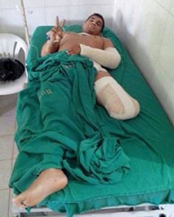 Vítima da imprudência do trânsito na Capital