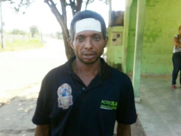 Lavador de carros escapa da morte ao ser alvejado com vários tiros