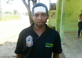 Lavador de carros escapa da morte ao ser alvejado com vários tiros