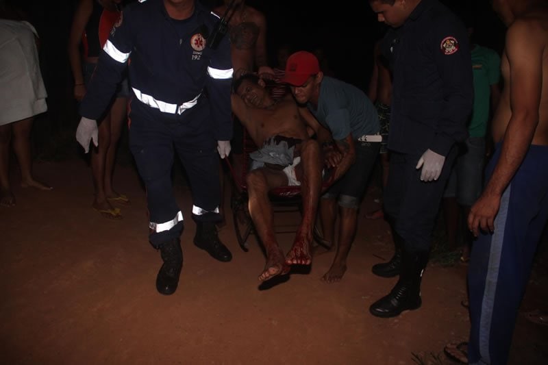 Homem atira em si mesmo acidentalmente 2 Tiro_na_virilha