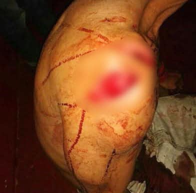 Vítima foi golpeada com foice