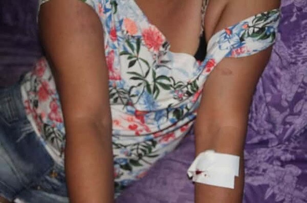 Bandido invade casa e espanca mulher atrás de dinheiro