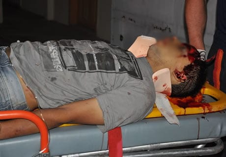 Motoqueiro morre ao se chocar em ponte metálica 3