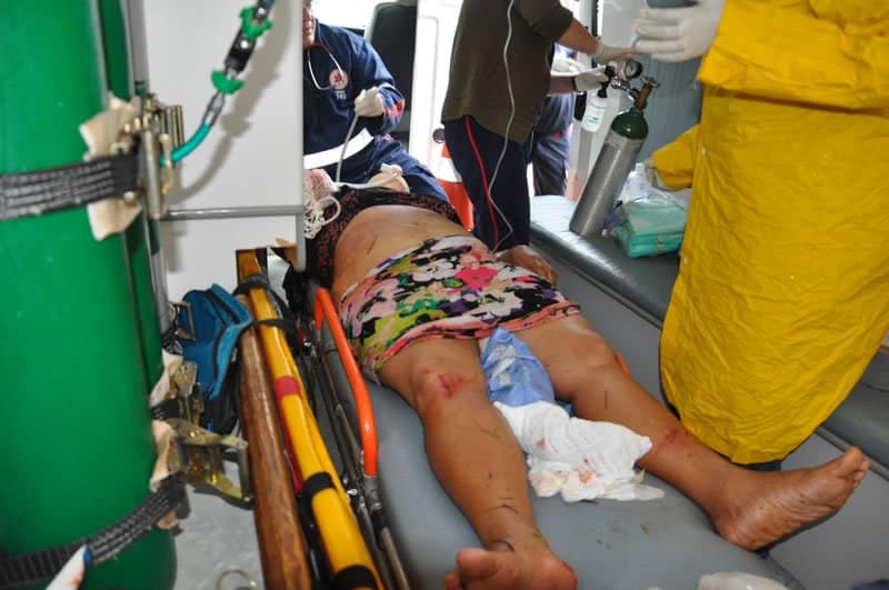 Mulher tem braço decepado em atropelamento no bairro Vila Acre 5