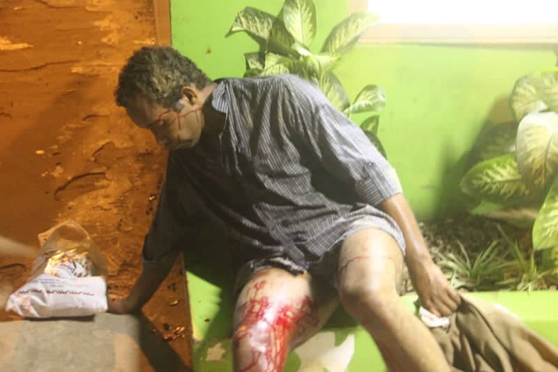 Casal bandido quase mata rapaz no Mercado Velho para assaltá-lo 2 Ananias estaria bebendo, quando foi esfaqueado