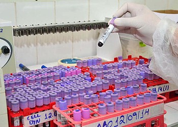 Novo sistema busca os meios mais sofisticados para agilizar a entrega de exames