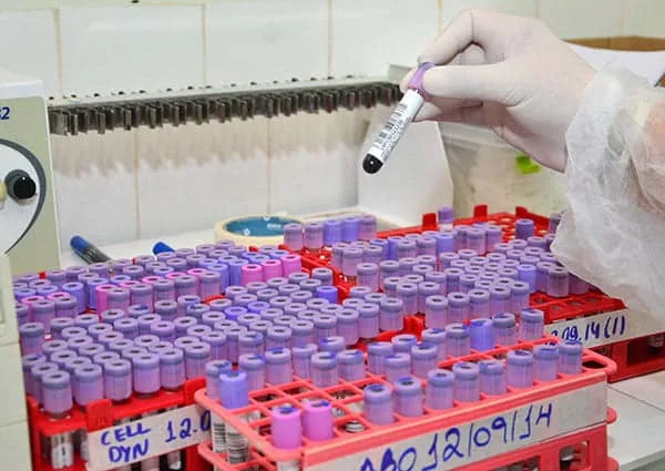 Novo sistema busca os meios mais sofisticados para agilizar a entrega de exames