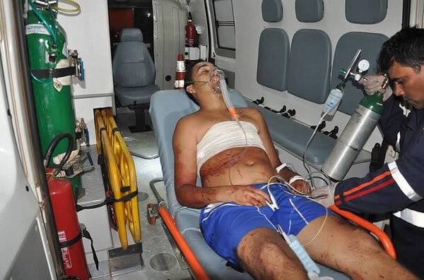 Menino de 11 anos atinge homem de 24 com terçado