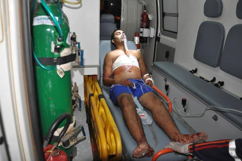 Homem é atingido com terçado por menino de 11 anos 2