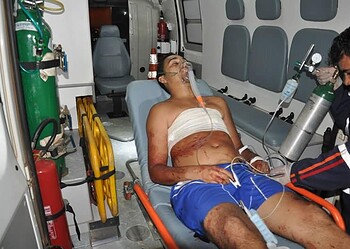 Menino de 11 anos atinge homem de 24 com terçado