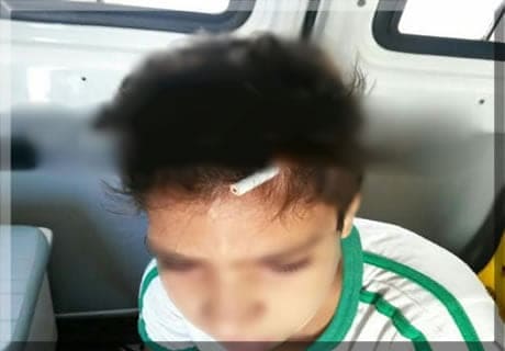 Aluno crava lápis na cabeça de colega durante discussão