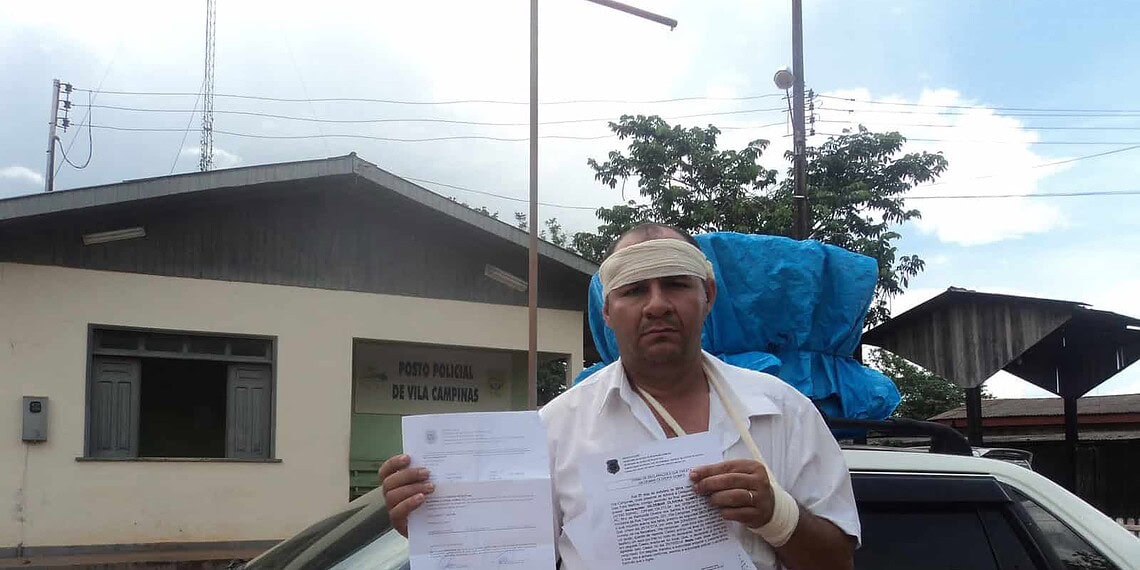 Ex-candidato denuncia agressão por causas políticas e diz que segue sendo ameaçado 1 Charqueiro alega ter sido agredido por militantes do PSDB