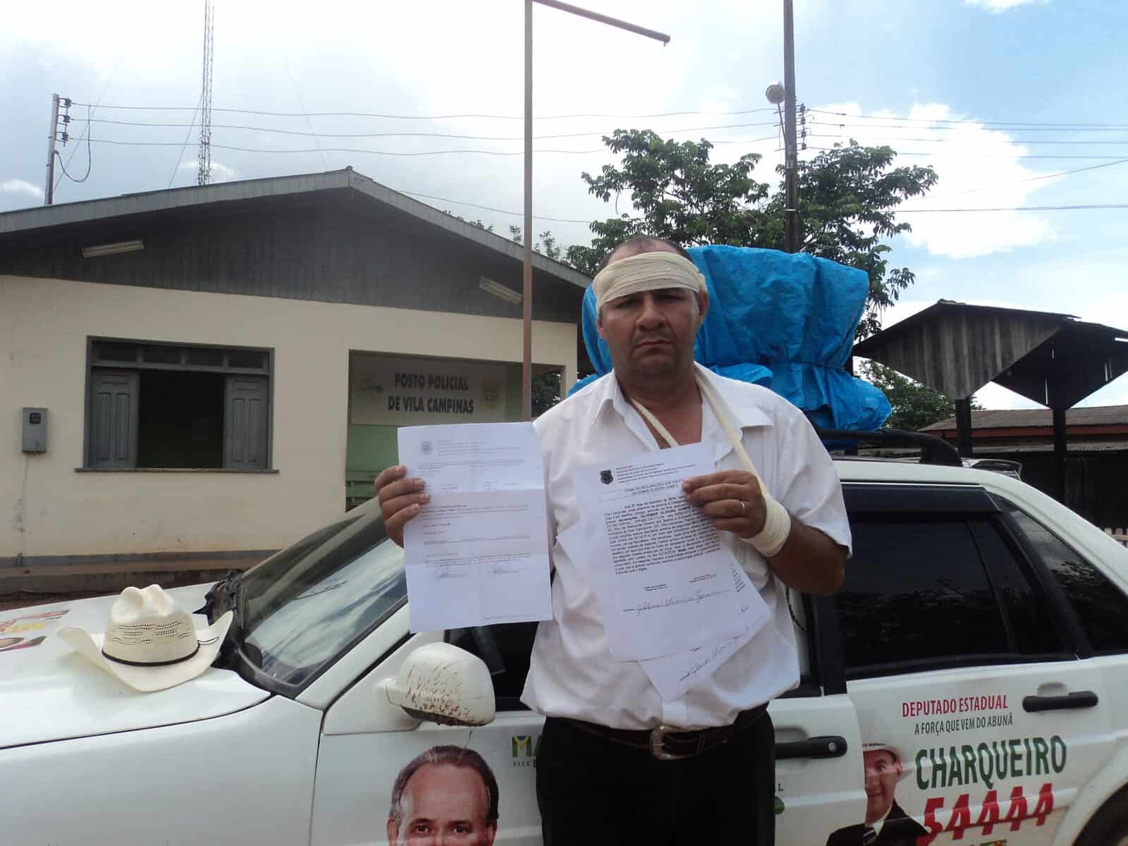 Ex-candidato denuncia agressão por causas políticas e diz que segue sendo ameaçado 2 Charqueiro alega ter sido agredido por militantes do PSDB