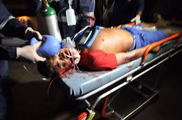 Jovem de 17 anos é assassinado com tiro na cabeça no Bairro da Paz