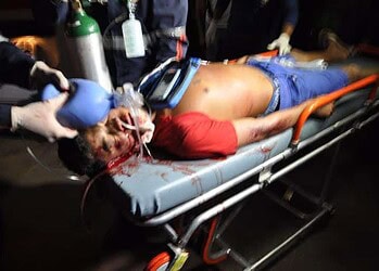 Jovem de 17 anos é assassinado com tiro na cabeça no Bairro da Paz