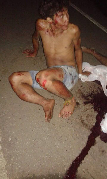 Acidente fatal na BR-364 divide homem em três partes