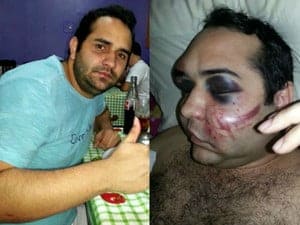 Fábio Germano, de 27 anos, passou por cirurgia para