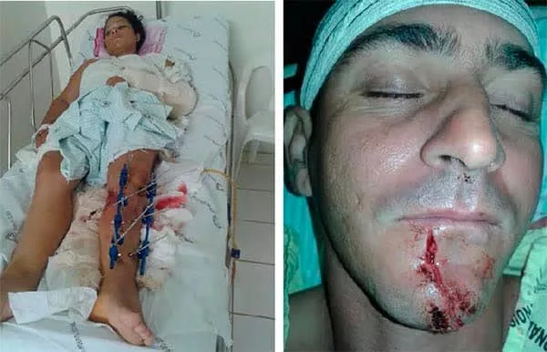 Alta velocidade pode ter provocado acidente entre lanchas