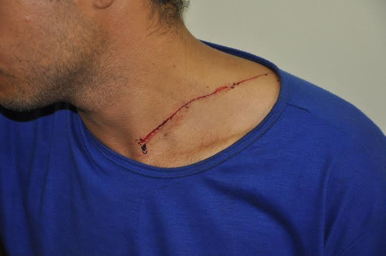 Rapaz é preso no dia do próprio aniversário acusado de tentativa de homicídio 2 Homem é preso no dia do seu aniversário acusado de tentativa de homicídio 2