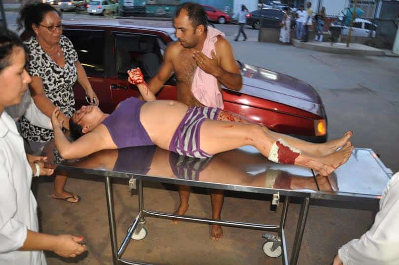 Mulher é esfaqueada após brigar com enteada 1 Mulher é esfaqueada após brigar com enteada no bairro Montanhês