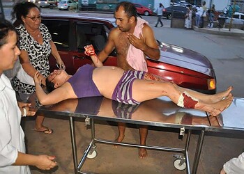 Mulher é esfaqueada após brigar com enteada