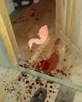 Mulher é esfaqueada várias vezes no bairro Boa União 1 Mulher é esfaqueada várias vezes no bairro Boa União