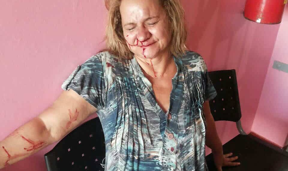 Luiza Vieira, 48, foi socorrida pelos agentes penitenciários e levada ao Pronto Socorro do Hospital do Juruá