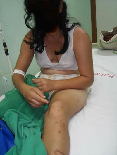 Jovem de 20 anos diz ter sido estuprada por três homens em Acrelândia 2 A jovem foi internada no Hospital Geral de Acrelândia