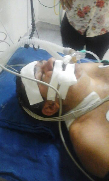 Irmãos gêmeos são assaltados e um deles é baleado na cabeça por ter pouco dinheiro