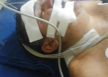 Irmãos gêmeos são assaltados e um deles é baleado na cabeça por ter pouco dinheiro