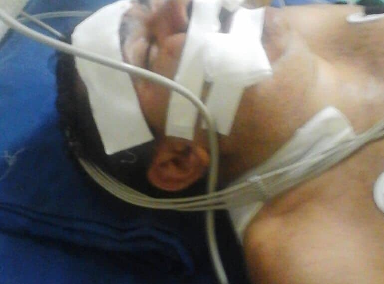 Irmãos gêmeos são assaltados e um deles é baleado na cabeça por ter pouco dinheiro