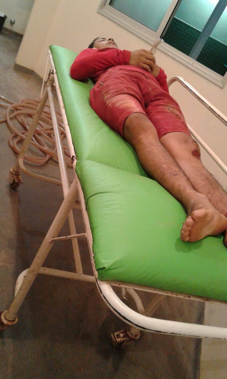 Jovem de 17 anos morre após colidir motocicleta contra cerca de residência 2