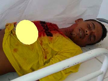 Anderson teria sido executado; polícia já tem suspeito