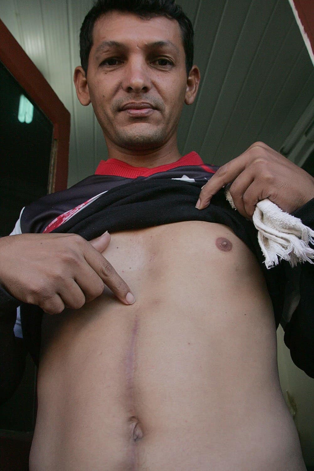 Juscelino Nascimento ainda carrega a cicatriz de uma das cinco facadas que quase lhe tiraram a vida em 2000. (Foto: Odair Leal/ A GAZETA)