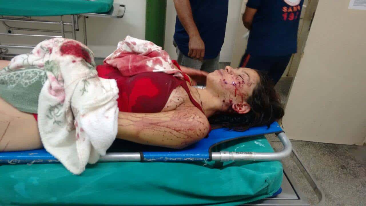 Adolescente de 17 anos tenta matar companheira com tiro de escopeta 2 Adolescente de 17 anos tenta matar companheira com tiro de escopeta 2