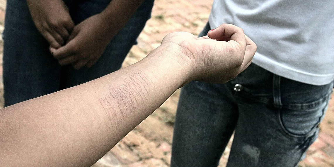 Depressão leva estudantes e praticarem a auto-mutilação. (Foto: Odair Leal/ A GAZETA)