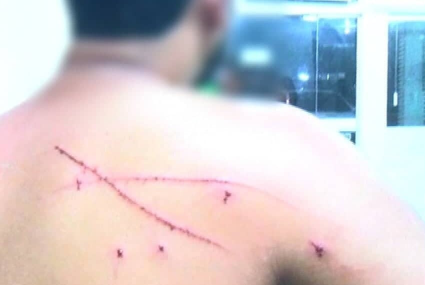 Vítima relatou ter sido  torturada por 5 homens