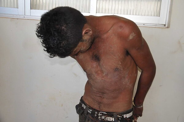 Homem é preso acusado de espancar mulher grávida