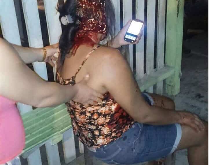 Briga de casal em bar termina com mulher agredida com taco de sinuca 1 Agressão ocorreu em um bar no município de Feijó