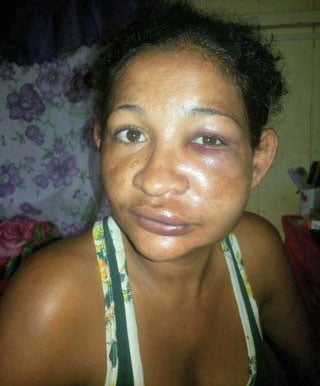 Vítima sofria agressões do marido