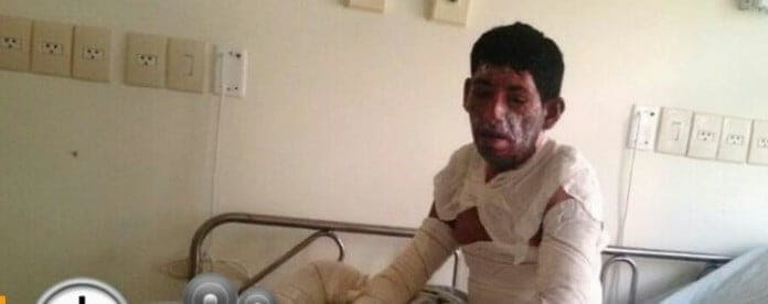 Bebedeira em Seringal termina com homem queimado vivo 2