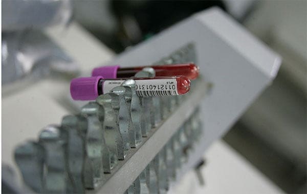 Nenhum acreano doou medula óssea 5 a2