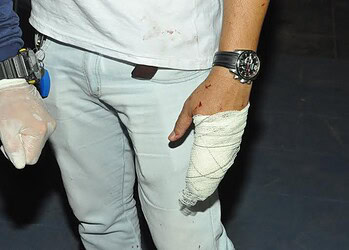 Atendente de Farmácia é ferido a tiro durante suposto assalto