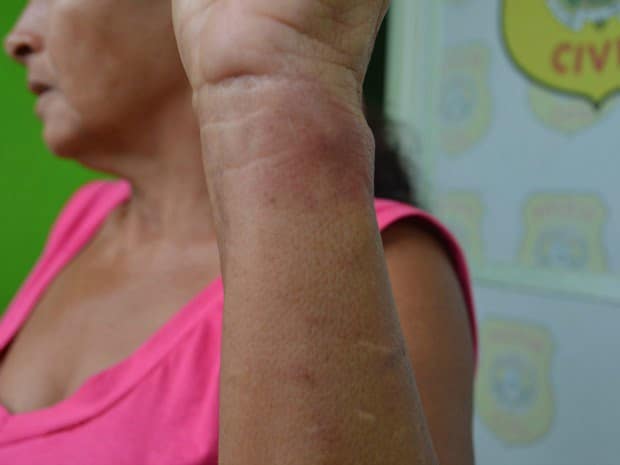 Bandidos armados invadem casa, espancam vítimas e são perseguidos, mas fogem da polícia 2 Antônia - Bandidos armados invadem casa