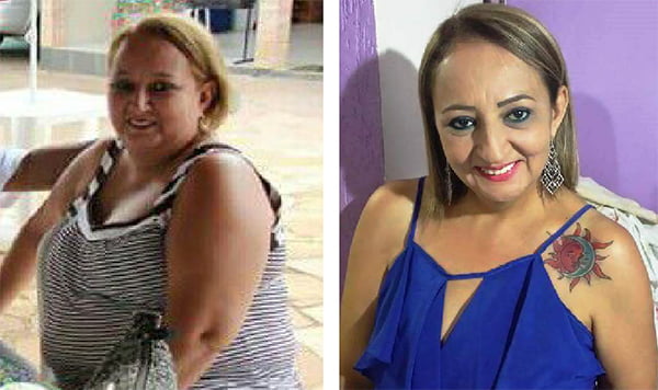 Rozimeire engordou quase 40 quilos em 6 anos devido à depressão. Hoje, ela já eliminou 37 quilos de forma saudável