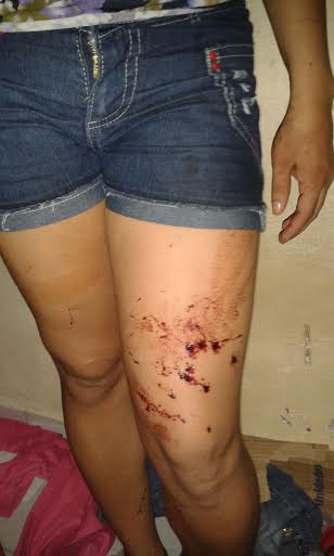 Detentas denunciam espancamentos e torturas dentro de Presídio 3 Detentas denunciam espancamento e torturas 2