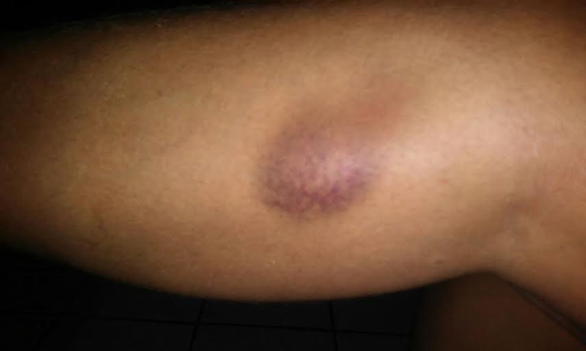 Detentas denunciam espancamentos e torturas dentro de Presídio 2 Detentas denunciam espancamento e torturas 3